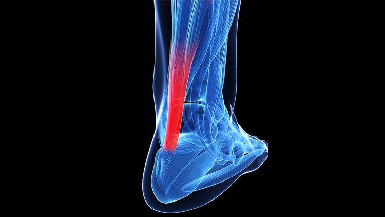 Dreidimensionale Darstellung des menschlichen Fußes. Rot hervorgehoben die Achillessehne. 