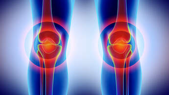 Knee painful - skeleton x-ray.