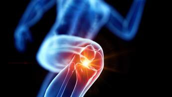 Runner with knee pain, conceptual illustration